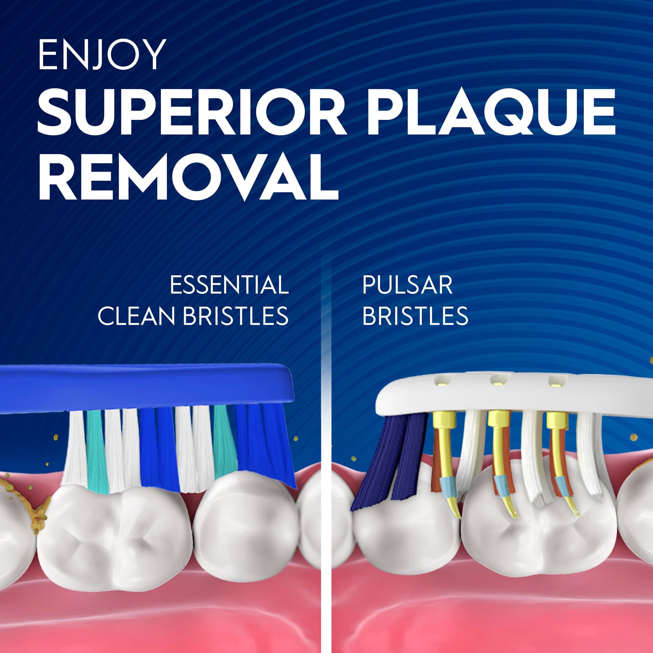 Toothbrush Pack, Expert Clean Pulsar Battery Powered Toothbrush, Medium, 2 Count