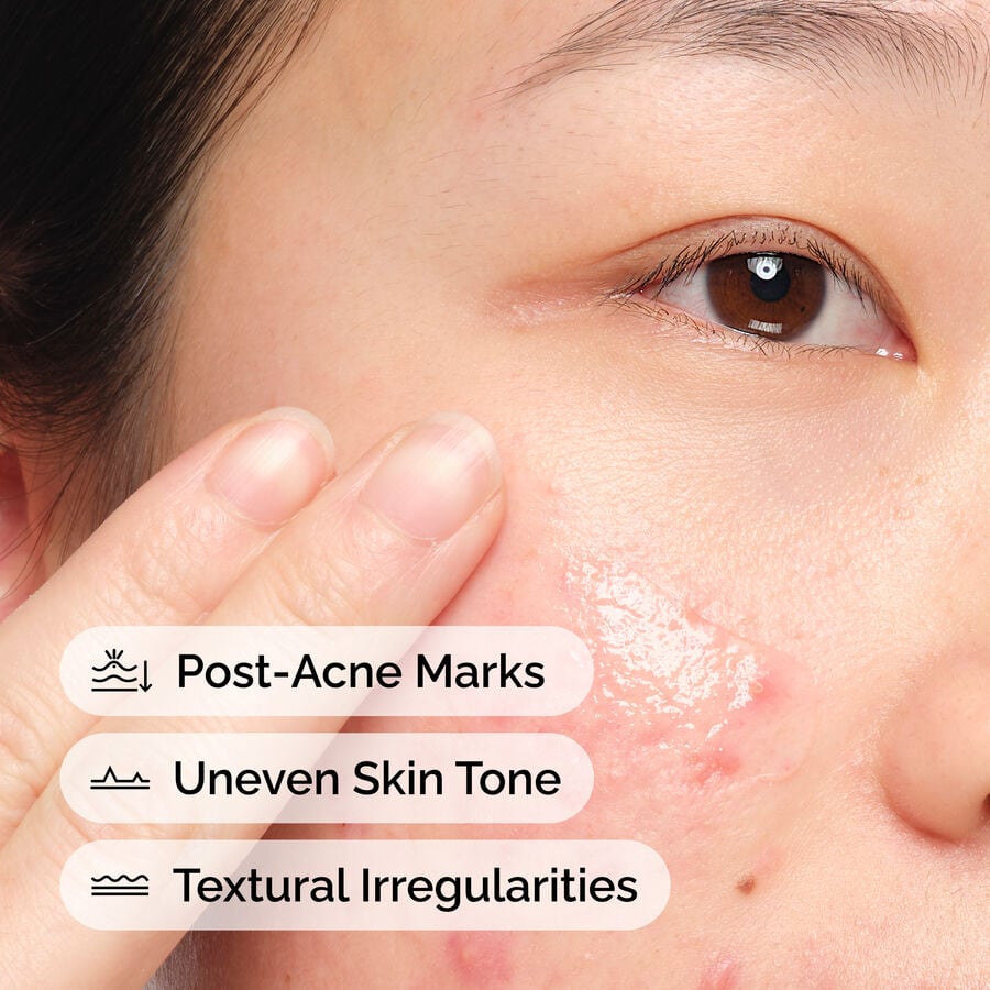 Model Application of the Aloe 2% + NAG 2% Solution 