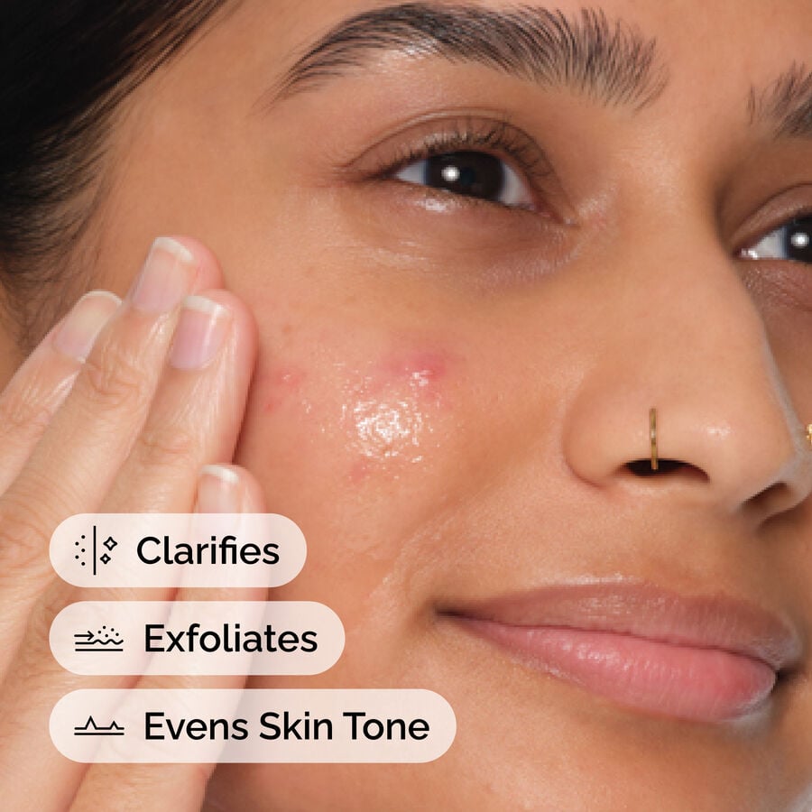 Application of The Ordinary Salicylic Acid 2% Anhydrous Serum 